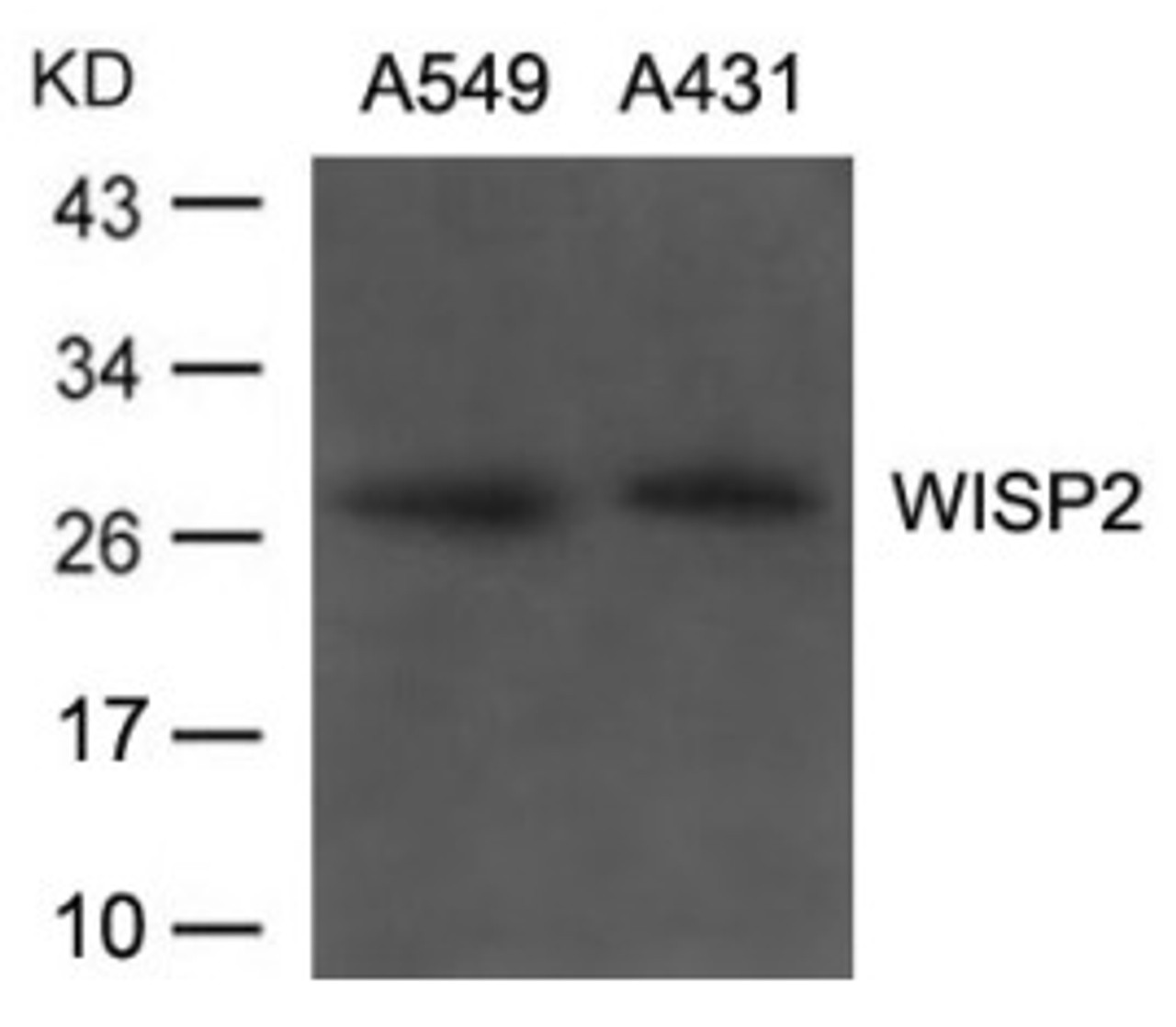 Western blot analysis of lysed extracts from A549, A431 cells using WISP2 Antibody.