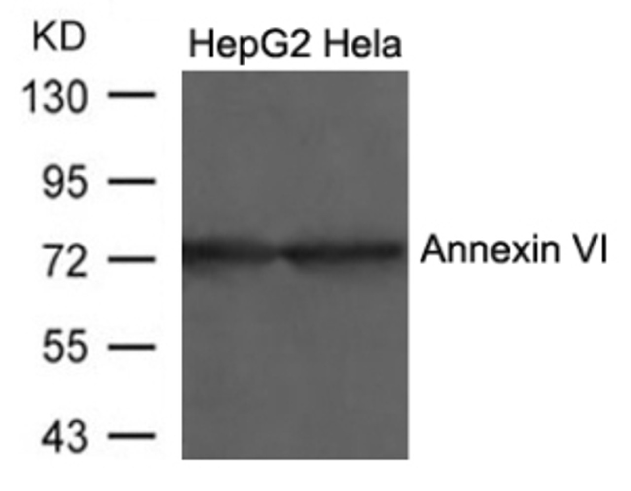 Western blot analysis of lysed extracts from HepG2 and HeLa cells using Annexin VI Antibody.