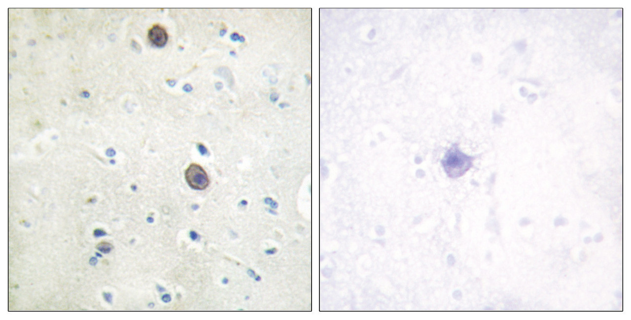 Immunohistochemical analysis of paraffin-embedded human brain tissue using Amyloid beta A4 (phospho-Thr743/668) antibody (left) or the same antibody preincubated with blocking peptide (right) .