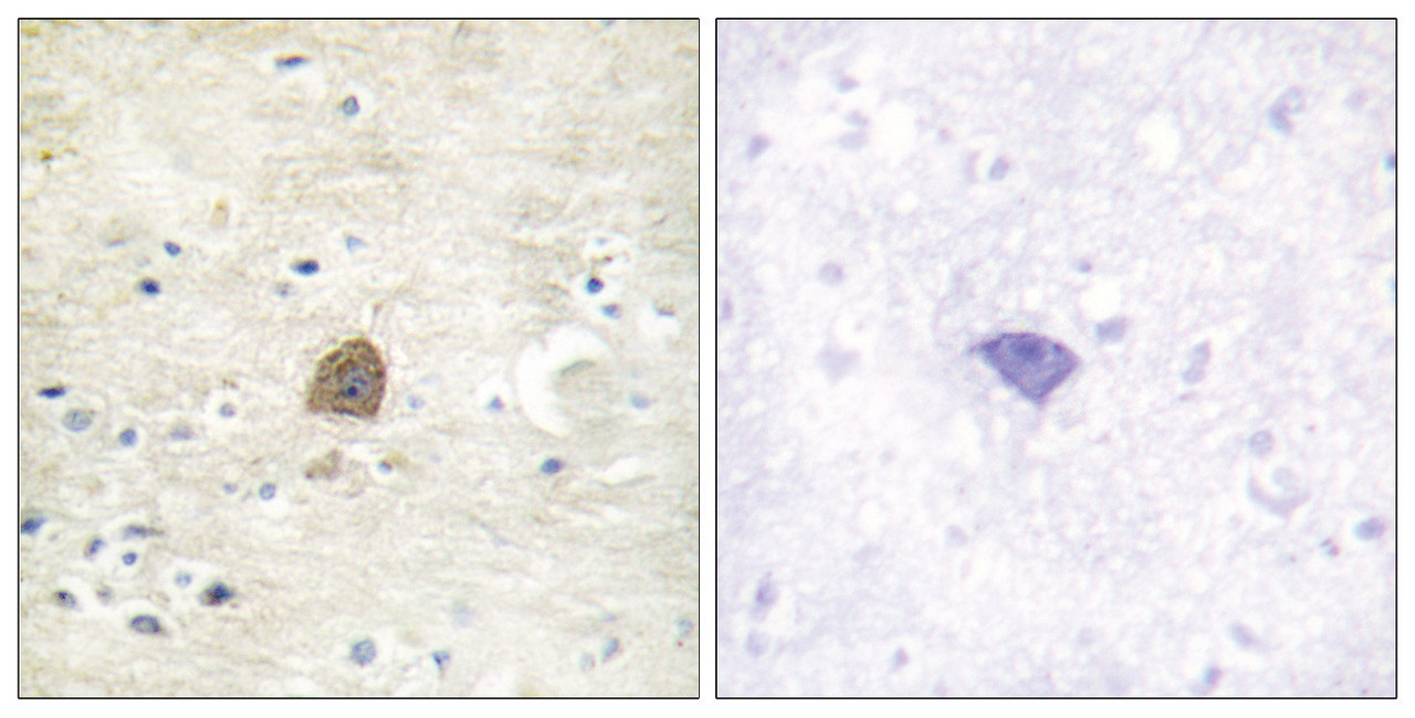 Immunohistochemical analysis of paraffin-embedded human brain tissue using CaMKII (Phospho-Thr305) antibody (left) or the same antibody preincubated with blocking peptide (right) .