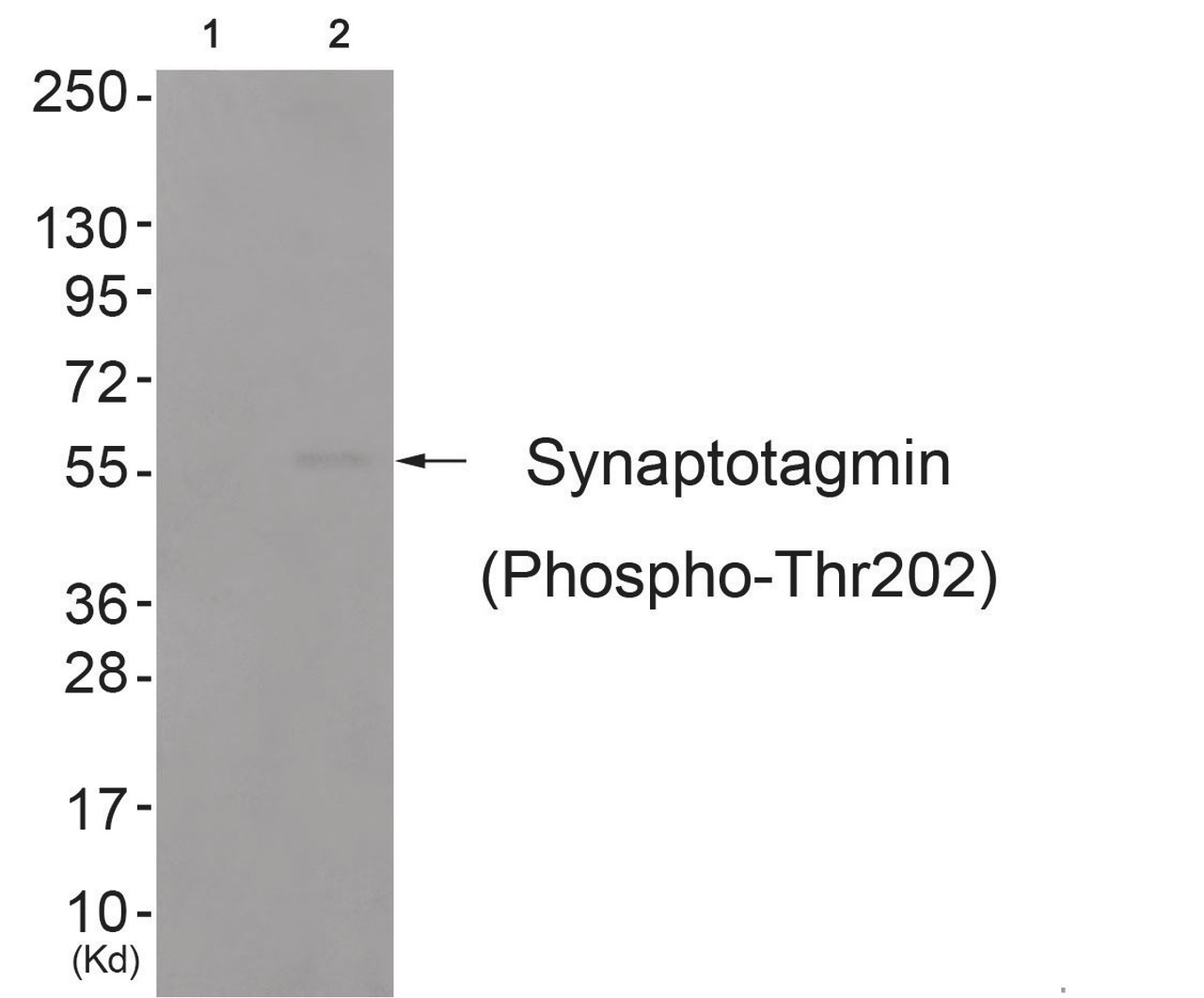 Western blot analysis of extracts from colo cells (Lane 2) , using Synaptotagmin (Phospho-Thr202) Antibody. The lane on the left is treated with antigen-specific peptide.