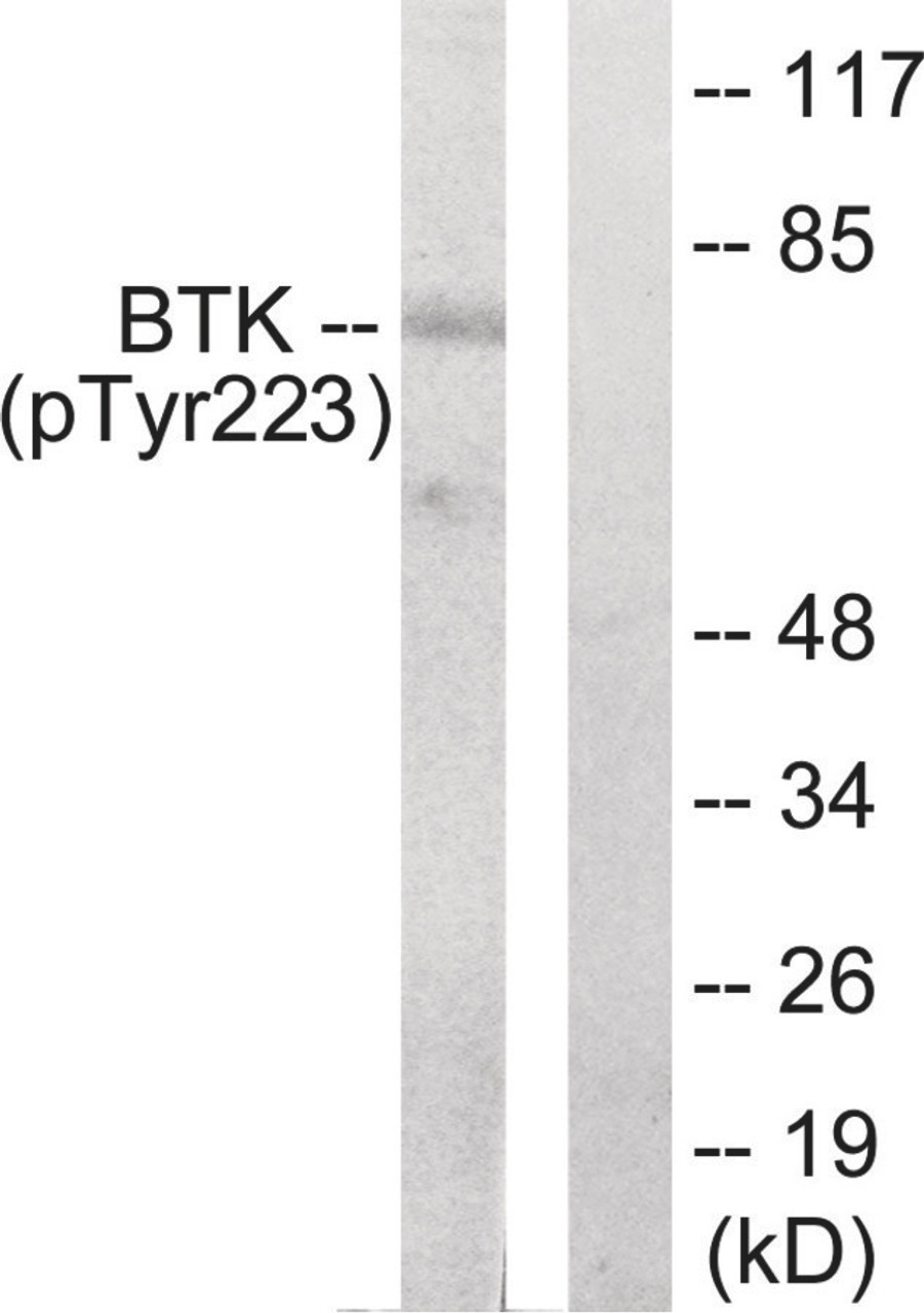 Western blot analysis of extracts from Hela cells treated with serum using BTK (phospho-Tyr223) Antibody. The lane on the right is treated with the antigen-specific peptide.