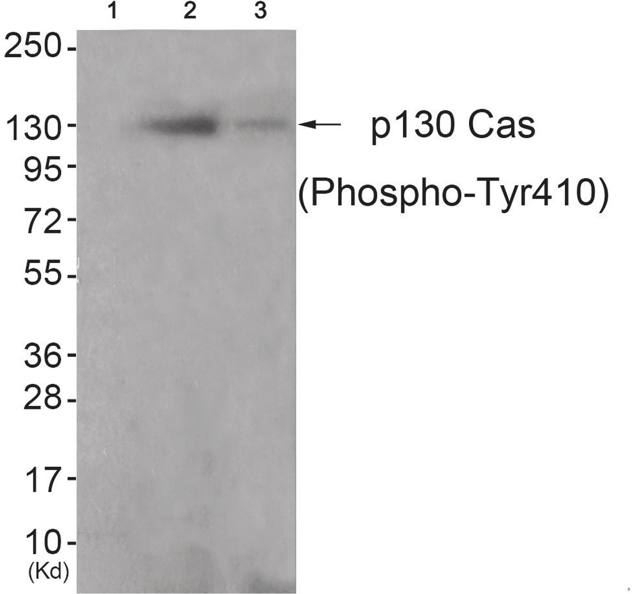 Western blot analysis of extracts from K562 cells (Lane 2) and 3T3 cells (Lane 3) , using P130 Cas (Phospho-Tyr410) Antibody. The lane on the left is treated with antigen-specific peptide.
