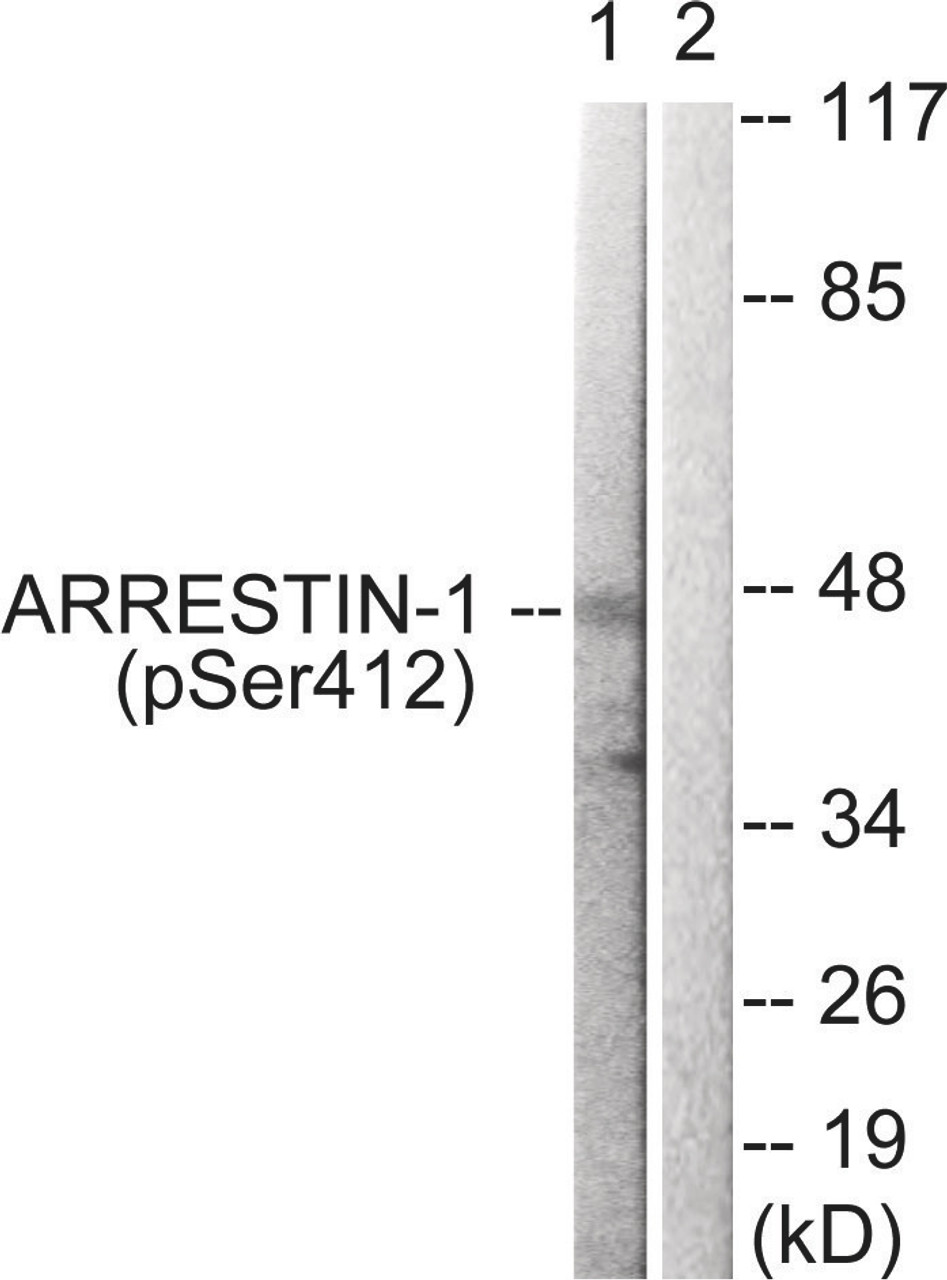 Western blot analysis of extracts from COS7 cells treated with Etoposide using Arrestin 1 (Phospho-Ser412) Antibody. The lane on the right is treated with the antigen-specific peptide.