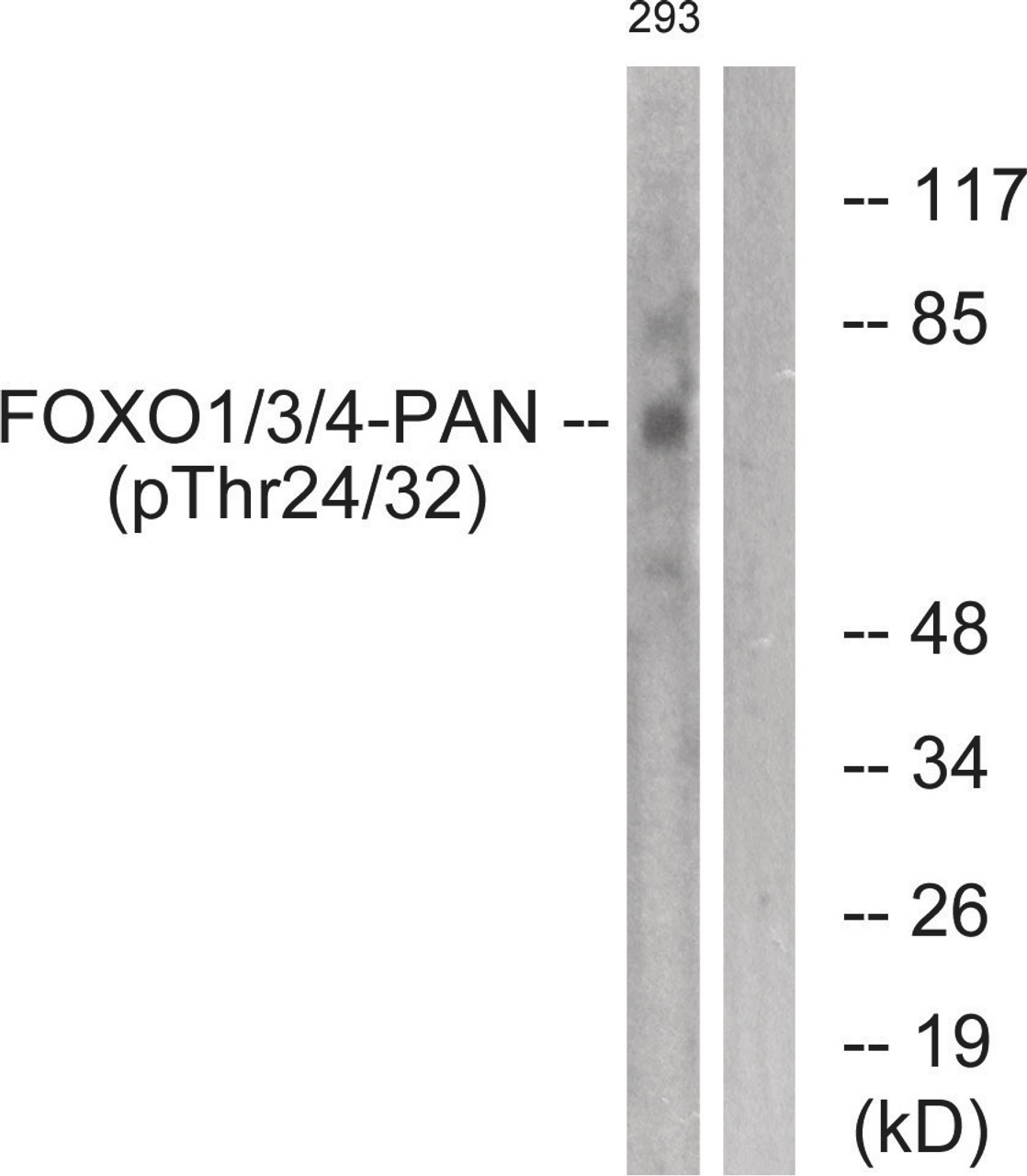 Western blot analysis of extracts from 293 cells treated with Serum using FOXO1/3/4-pan (Phospho-Thr24/32) Antibody. The lane on the right is treated with the antigen-specific peptide.