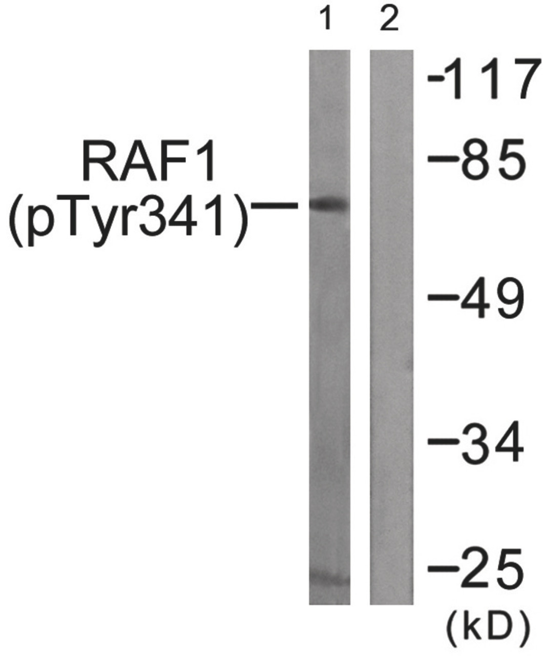 Western blot analysis of extracts from Jurkat cells treated with Paclitaxel using Raf1 (Phospho-Tyr341) Antibody. The lane on the right is treated with the antigen-specific peptide.