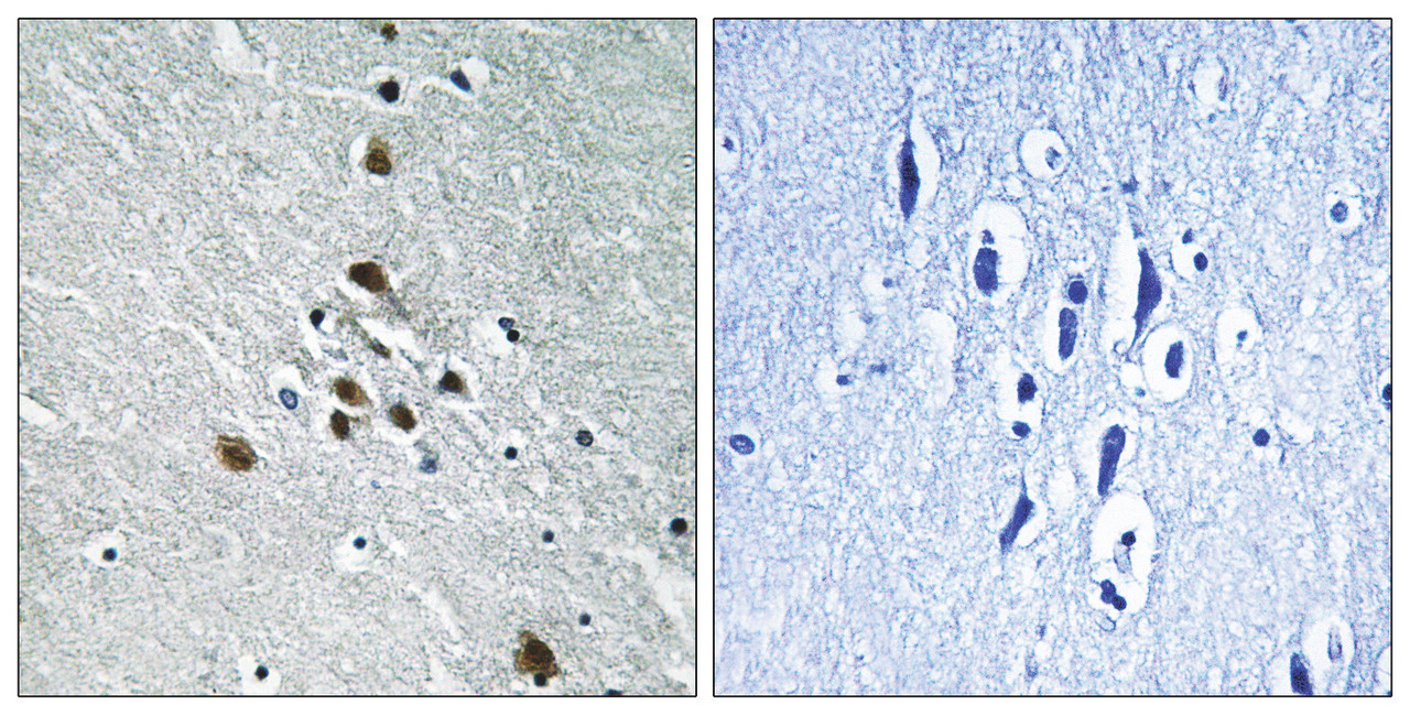 Immunohistochemical analysis of paraffin-embedded human brain tissue using SF1 (Phospho-Ser82) antibody (left) or the same antibody preincubated with blocking peptide (right) .
