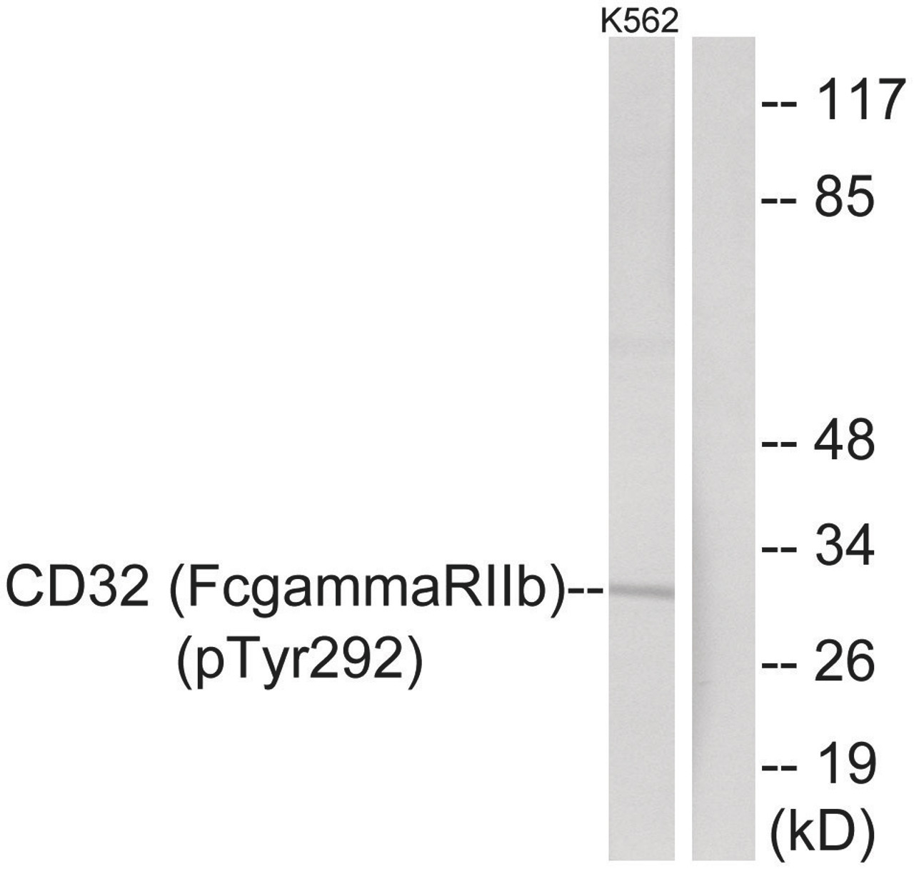 Western blot analysis of extracts from K562 cells treated with PMA using CD32 (Phospho-Tyr292) Antibody. The lane on the right is treated with the antigen-specific peptide.