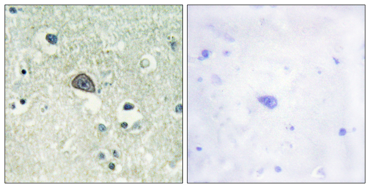 Immunohistochemical analysis of paraffin-embedded human brain tissue using NMDAR1 (Phospho-Ser890) antibody (left) or the same antibody preincubated with blocking peptide (right) .