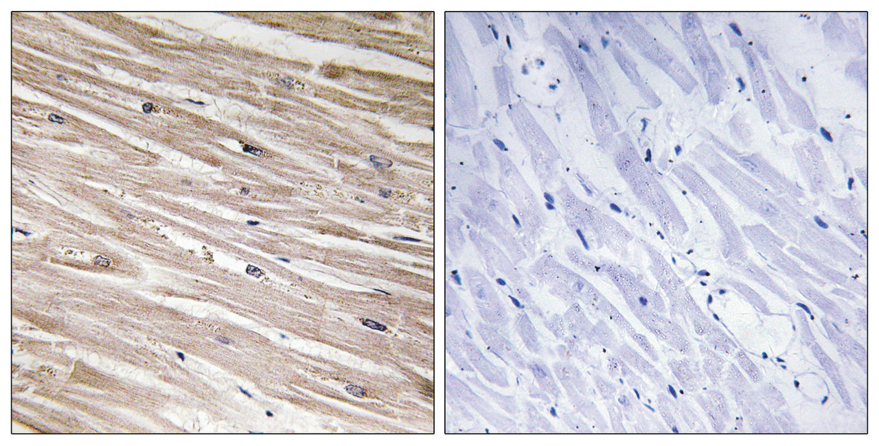 Immunohistochemical analysis of paraffin-embedded human heart tissue using PEA-15 (Phospho-Ser104) antibody (left) or the same antibody preincubated with blocking peptide (right) .