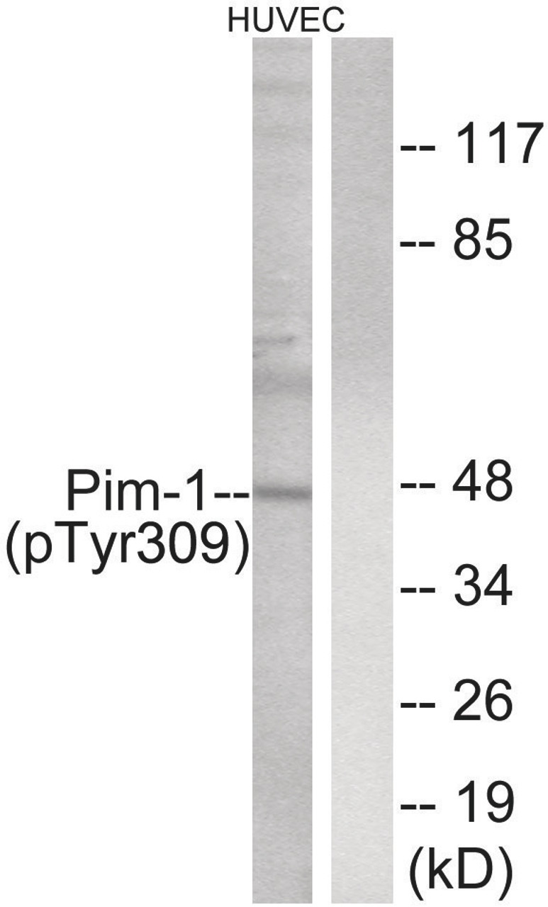 Western blot analysis of extracts from HUVEC cells treated with PMA using Pim-1 (Phospho-Tyr309) Antibody. The lane on the right is treated with the antigen-specific peptide.