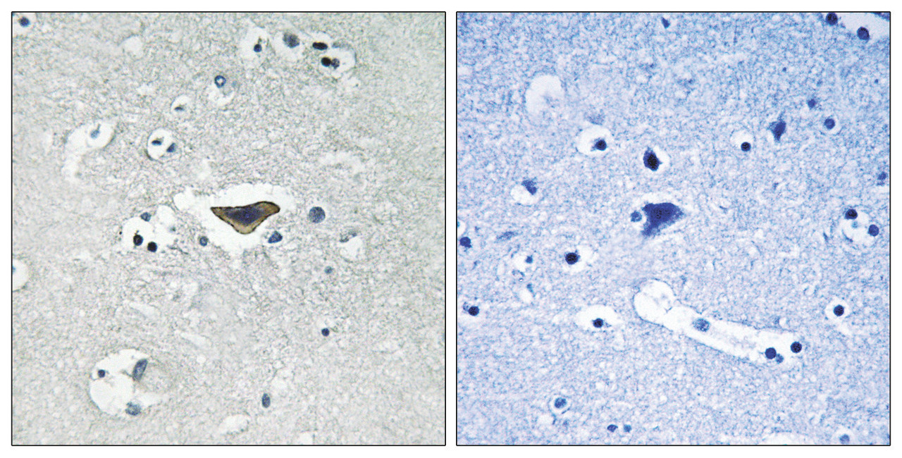 Immunohistochemical analysis of paraffin-embedded human brain tissue using Ras-GRF1 (Phospho-Ser916) antibody (left) or the same antibody preincubated with blocking peptide (right) .