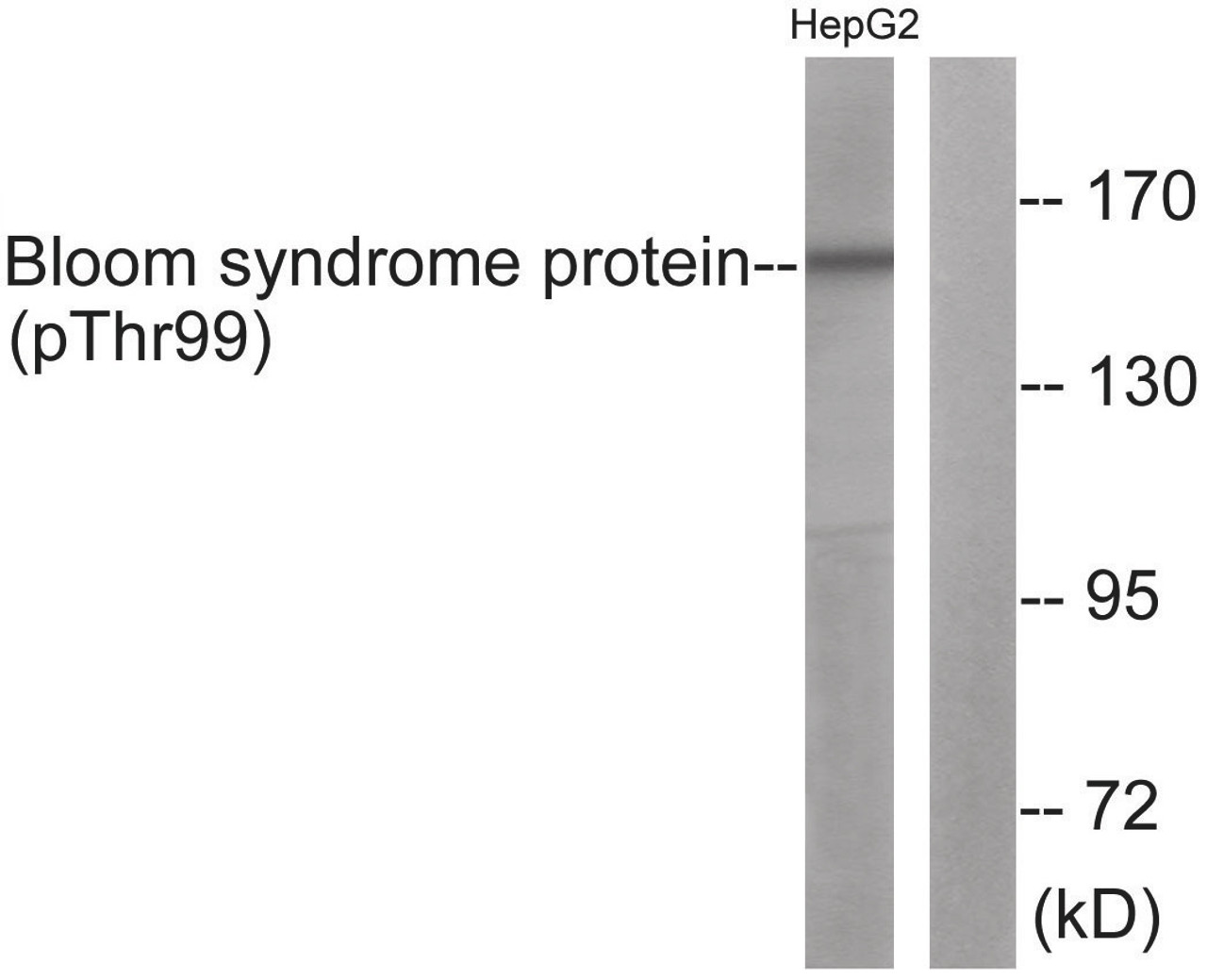 Western blot analysis of extracts from HepG2 cells using Bloom Syndrome Protein (Phospho-Thr99) Antibody. The lane on the right is treated with the antigen-specific peptide.