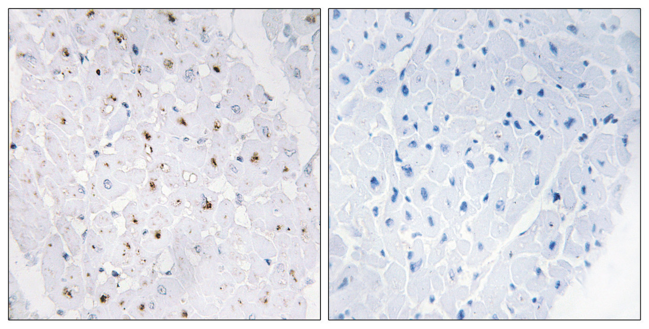 Immunohistochemical analysis of paraffin-embedded human heart tissue, using Bloom Syndrome Protein (Phospho-Thr99) antibody (left) or the same antibody preincubated with blocking peptide (right) .
