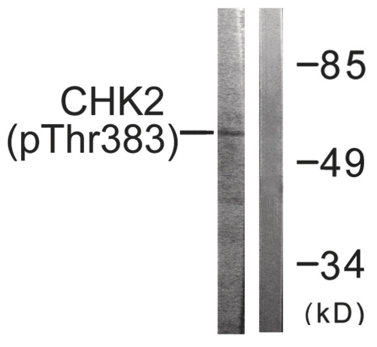 Western blot analysis of extracts from COS7 cells treated with UV using Chk2 (Phospho-Thr383) Antibody. The lane on the right is treated with the antigen-specific peptide.