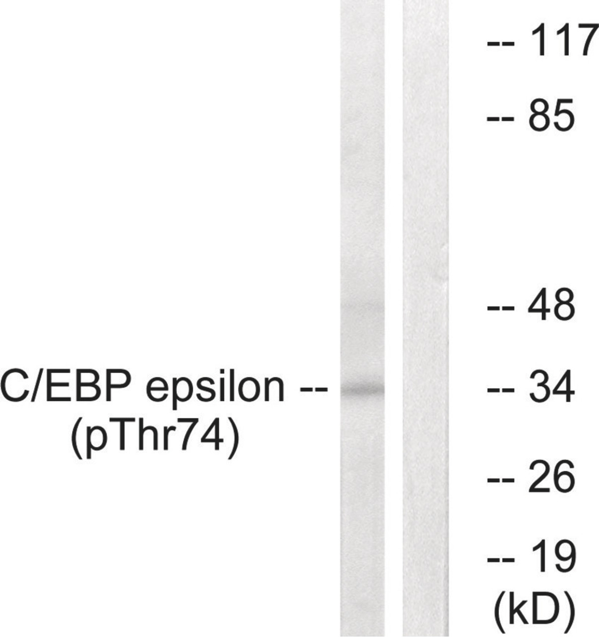 Western blot analysis of extracts from HUVEC cells treated with UV using C/EBP-ε (Phospho-Thr74) Antibody. The lane on the right is treated with the antigen-specific peptide.
