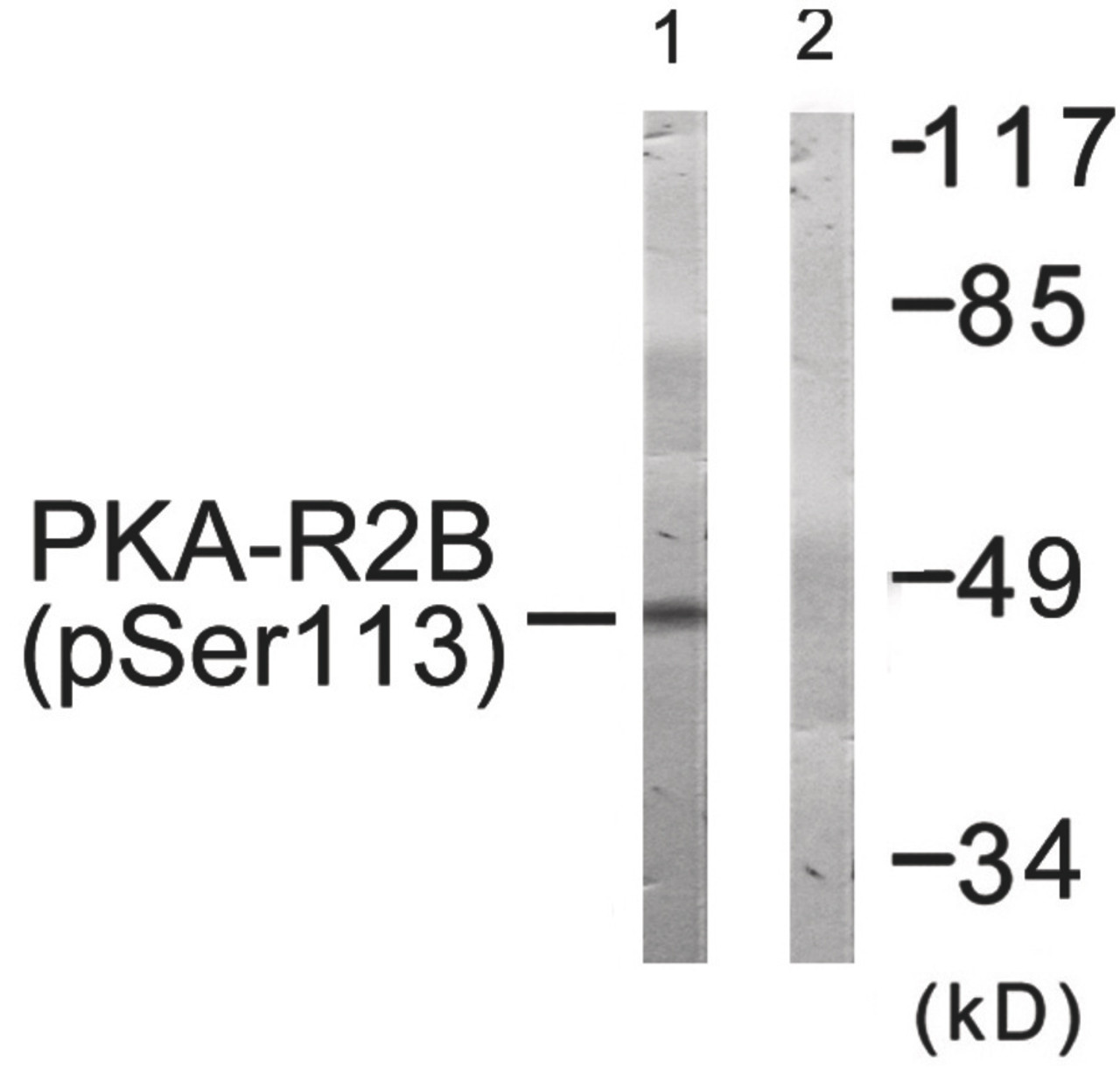 Western blot analysis of extracts from COS-7 cells treated with PMA using PKA-R2beta (Phospho-Ser113) Antibody. The lane on the right is treated with the antigen-specific peptide.
