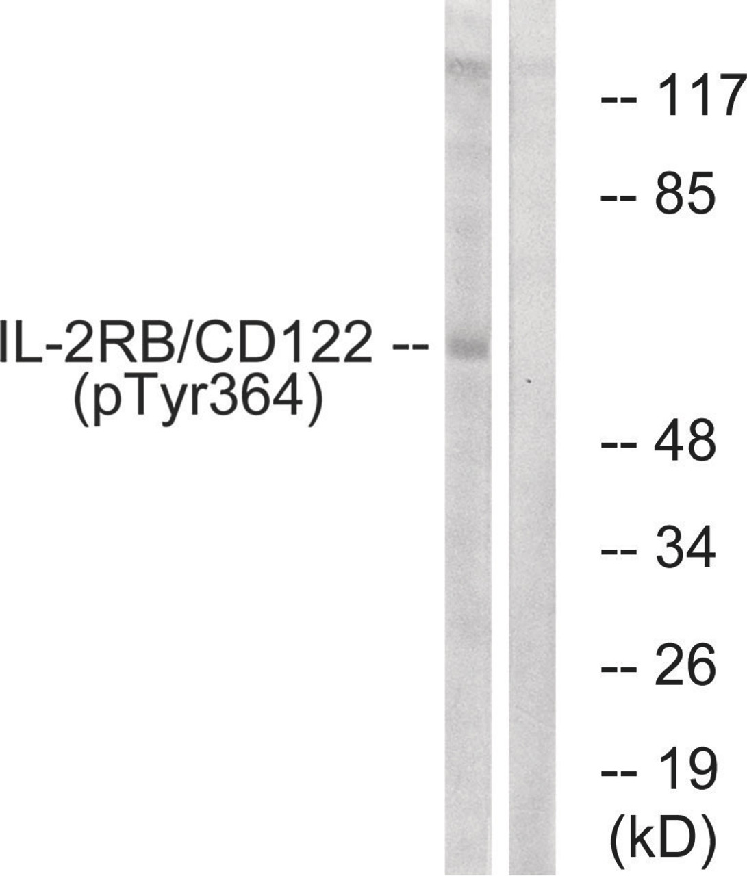 Western blot analysis of extracts from COS7 cells using IL-2Rbeta/CD122 (Phospho-Tyr364) Antibody. The lane on the right is treated with the antigen-specific peptide.