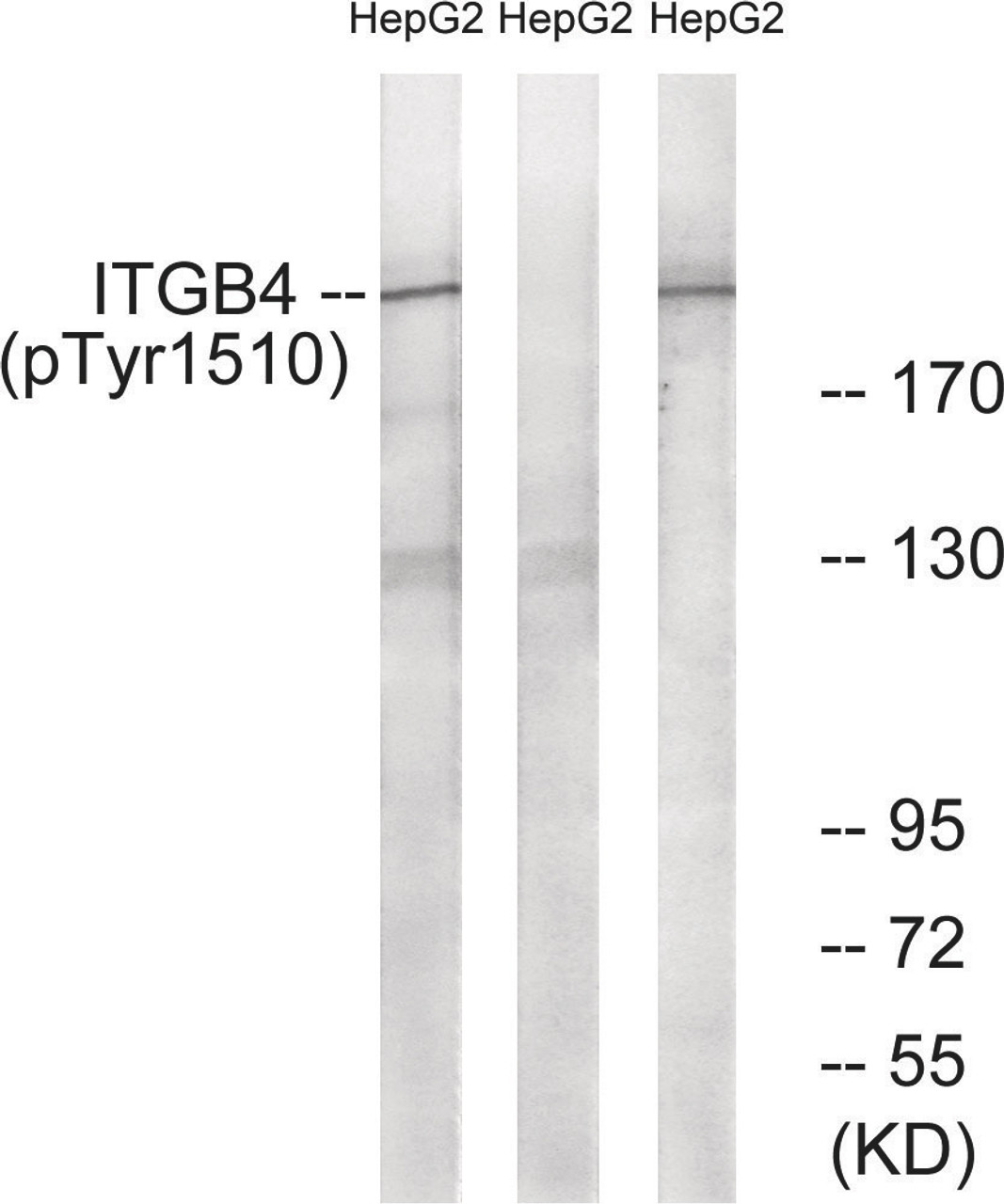 Western blot analysis of extracts from HepG2 cells treated with Na2VO3 using ITGB4 (Phospho-Tyr1510) Antibody. The lane on the right is treated with the antigen-specific peptide.