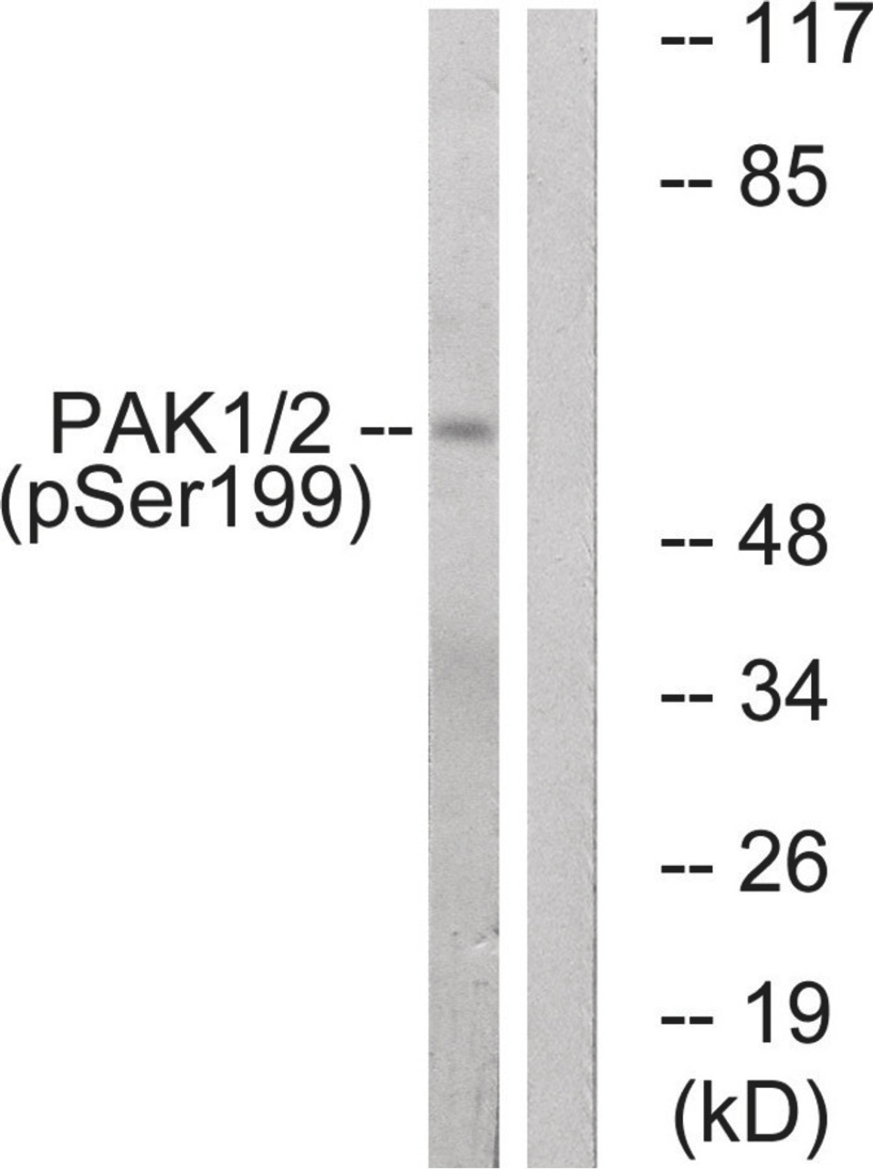 Western blot analysis of extracts from LOVO cells treated with starved using PAK1/2 (Phospho-Ser199) Antibody. The lane on the right is treated with the antigen-specific peptide.