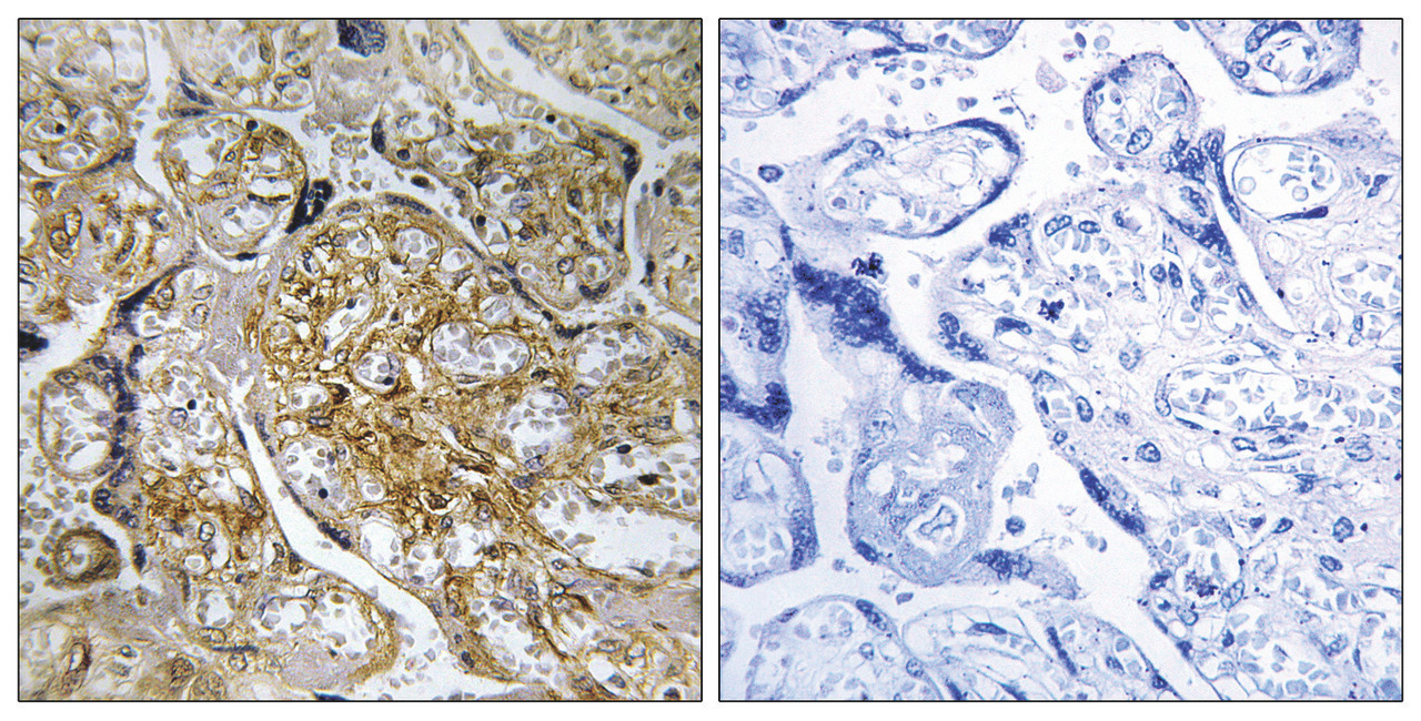 Immunohistochemical analysis of paraffin-embedded human placenta tissue using PAK1/2 (Phospho-Ser199) antibody (left) or the same antibody preincubated with blocking peptide (right) .