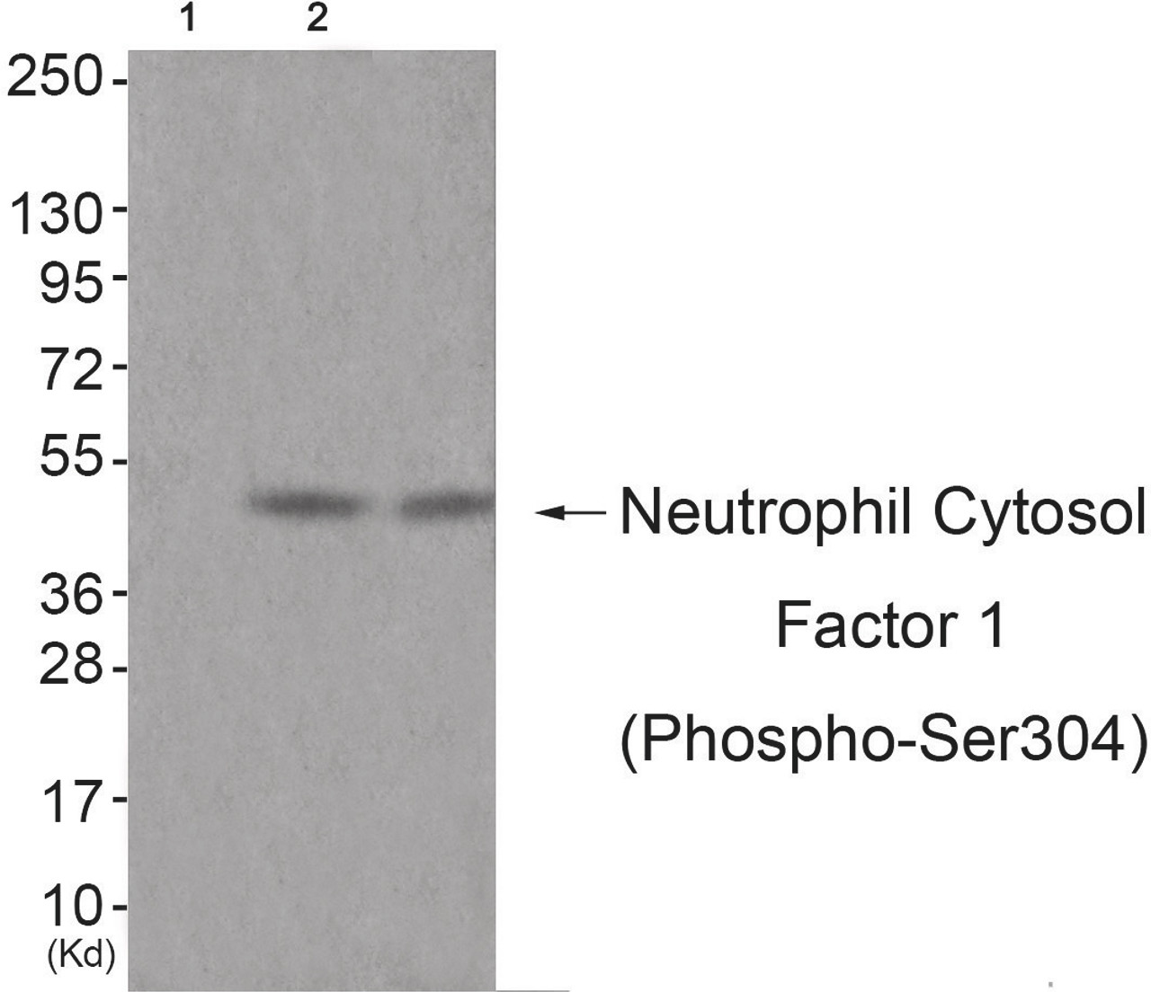 Western blot analysis of extracts from JK cells (Lane 2) and cos-7 cells (Lane 3) , using Neutrophil Cytosol Factor 1 (Phospho-Ser304) Antibody. The lane on the left is treated with antigen-specific peptide.