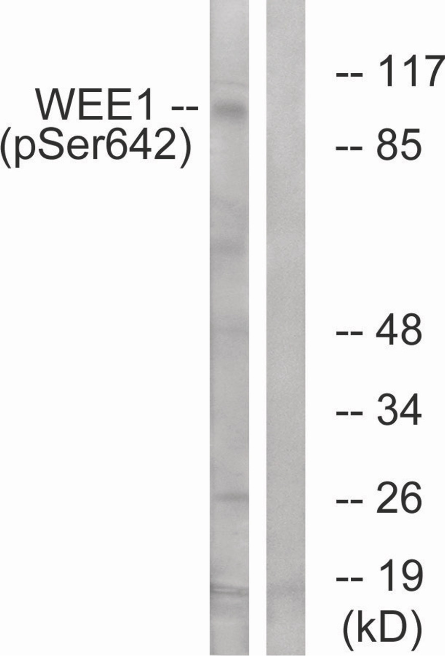 Western blot analysis of extracts from 293 cells treated with etoposide using WEE1 (Phospho-Ser642) Antibody. The lane on the right is treated with the antigen-specific peptide.