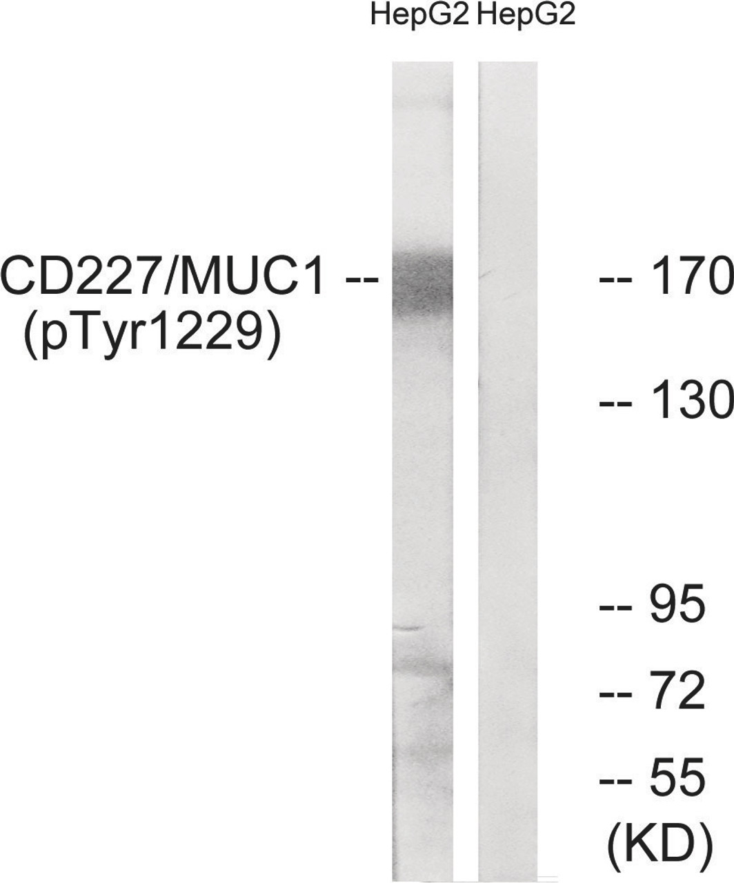 Western blot analysis of extracts from HepG2 cells treated with PMA using CD227/MUC1 (Phospho-Tyr1229) Antibody. The lane on the right is treated with the antigen-specific peptide.
