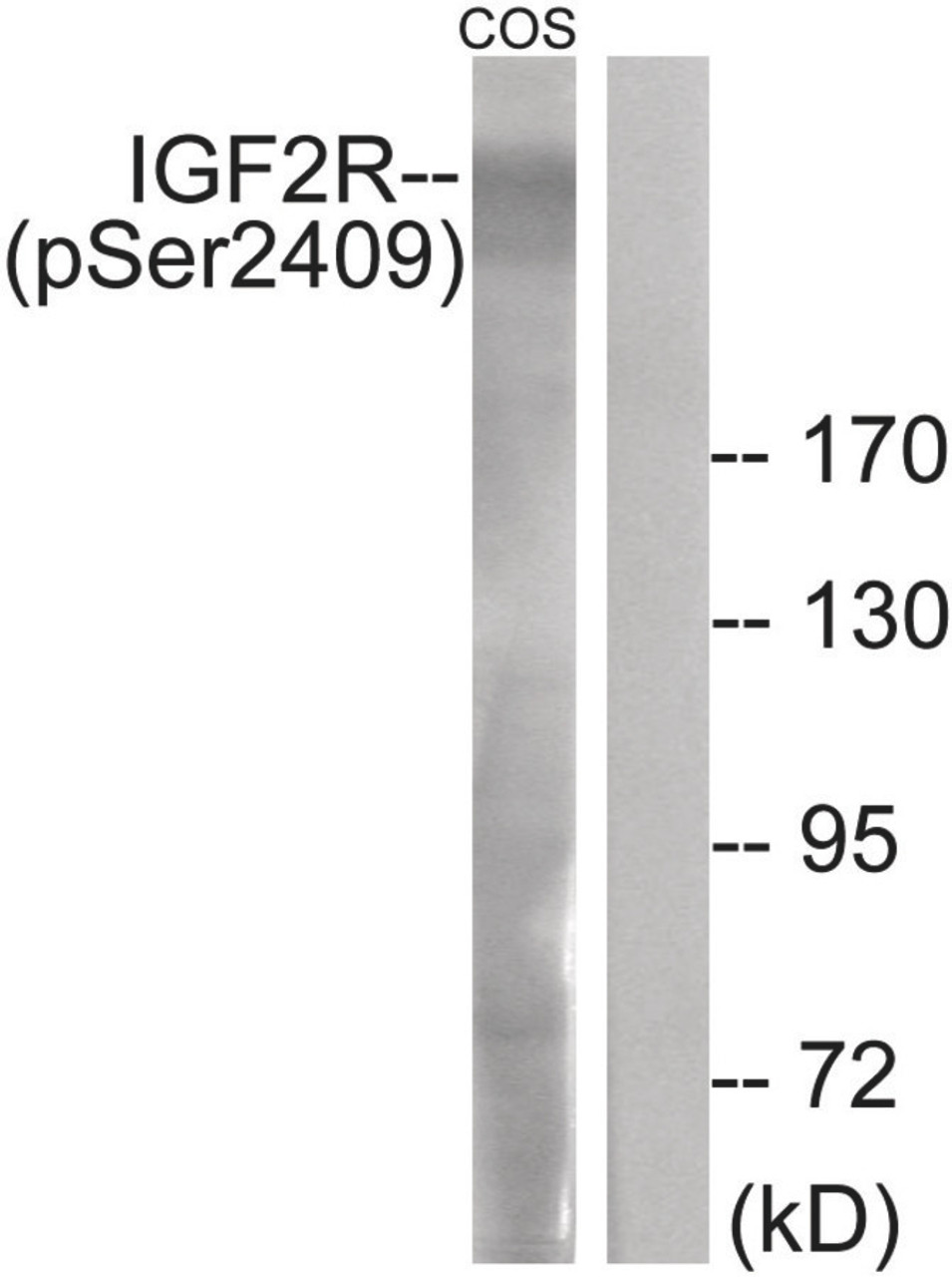 Western blot analysis of extracts from COS-7 cells treated with UV using IGF2R (Phospho-Ser2409) Antibody. The lane on the right is treated with the antigen-specific peptide.