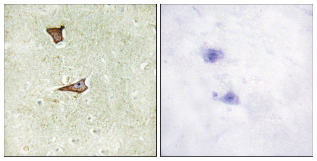 Immunohistochemical analysis of paraffin-embedded human brain tissue using IGF2R (Phospho-Ser2409) antibody (left) or the same antibody preincubated with blocking peptide (right) .