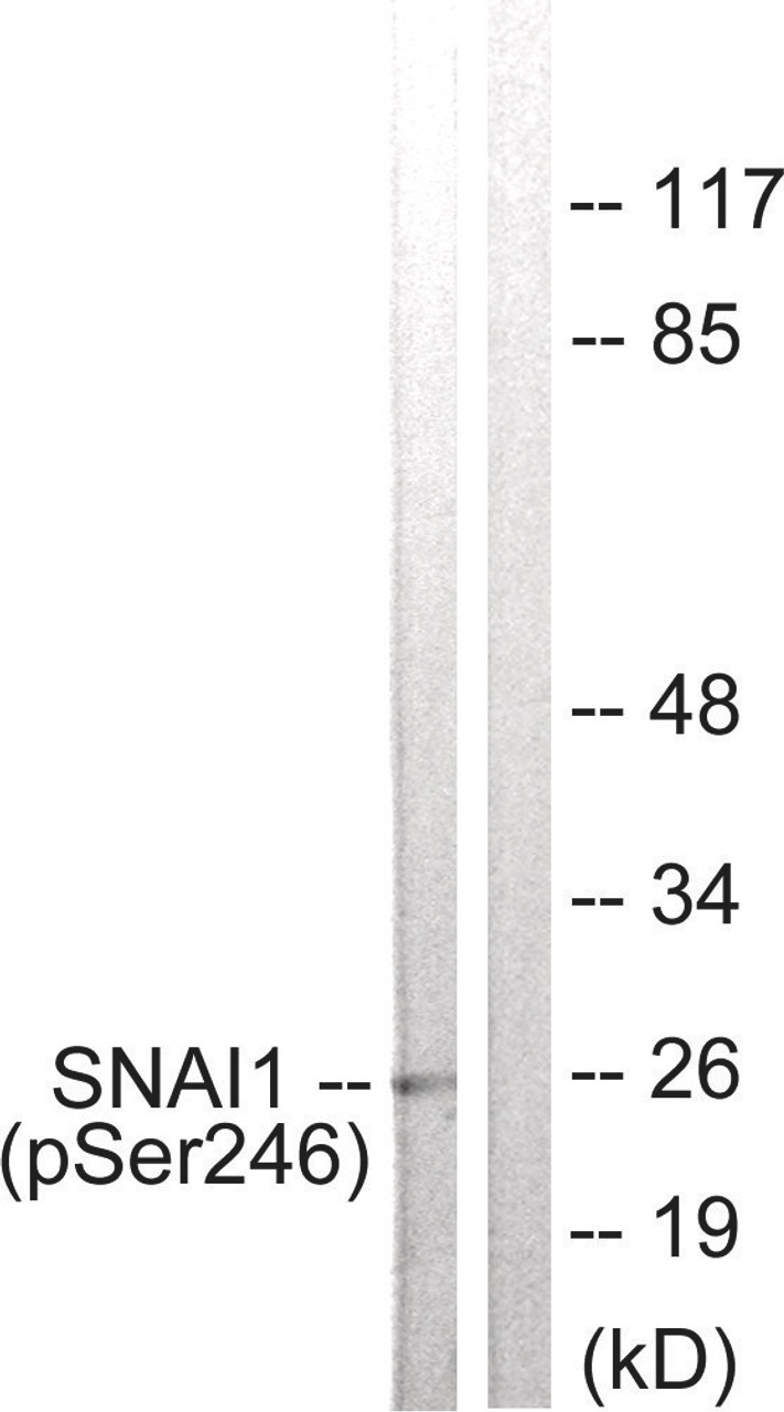 Western blot analysis of extracts from HT29 cells using SNAI1 (Phospho-Ser246) Antibody. The lane on the right is treated with the antigen-specific peptide.