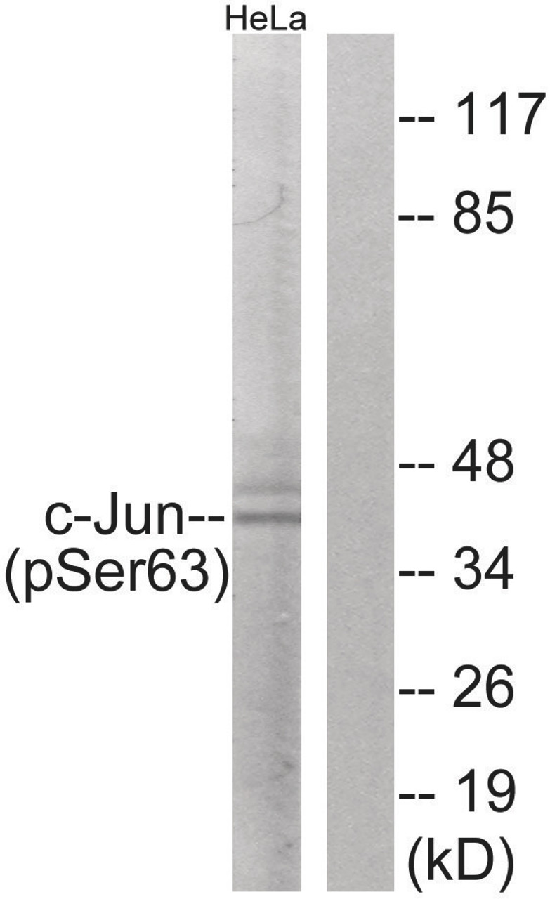 Western blot analysis of extracts from HeLa cells using c-Jun (Phospho-Ser63) Antibody. The lane on the right is treated with the antigen-specific peptide.