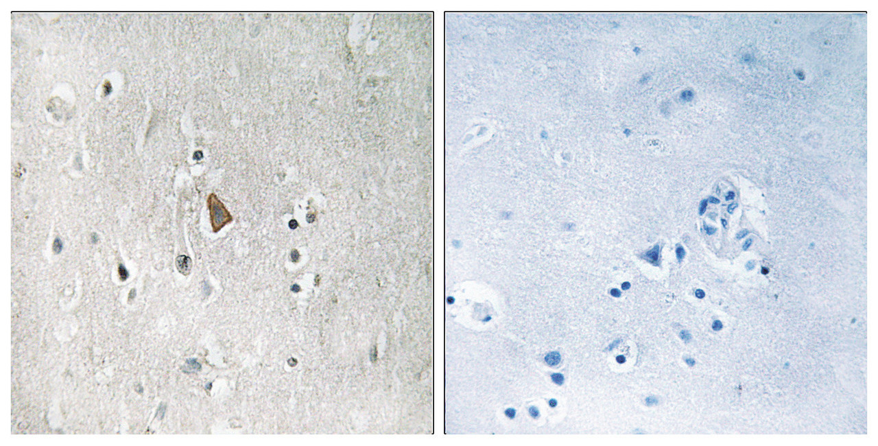 Immunohistochemical analysis of paraffin-embedded human brain tissue using IGF1R (Phospho-Tyr1346) antibody (left) or the same antibody preincubated with blocking peptide (right) .