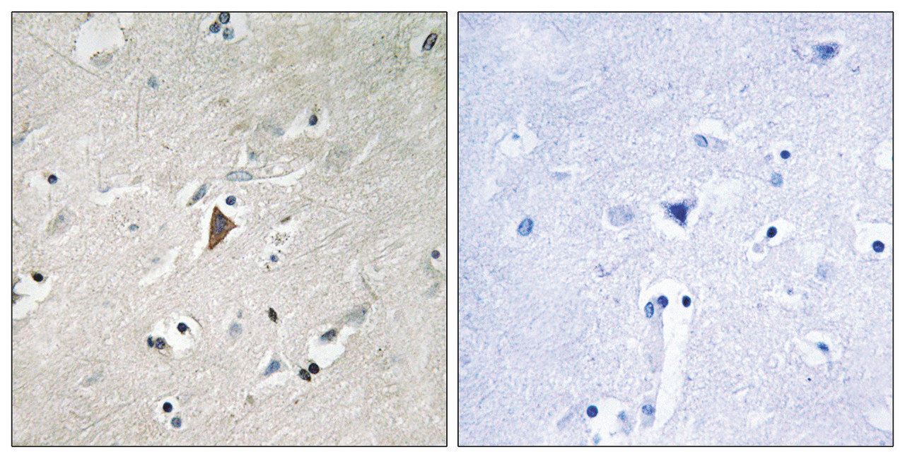 Immunohistochemical analysis of paraffin-embedded human brain tissue using PDK1 (Phospho-Tyr9) antibody (left) or the same antibody preincubated with blocking peptide (right) .
