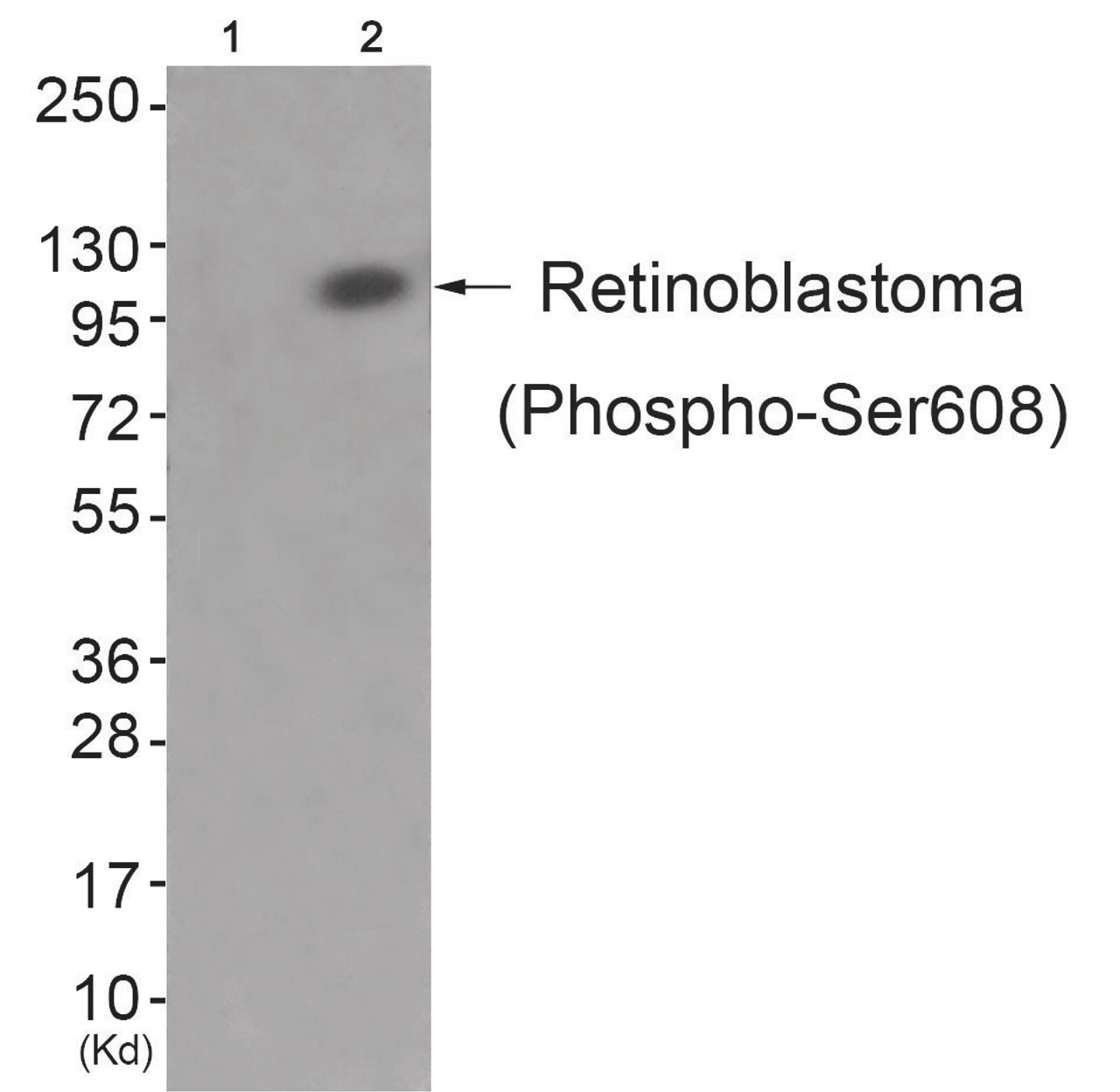 Western blot analysis of extracts from JK cells (Lane 2) , using Retinoblastoma (Phospho-Ser608) Antibody. The lane on the left is treated with antigen-specific peptide.