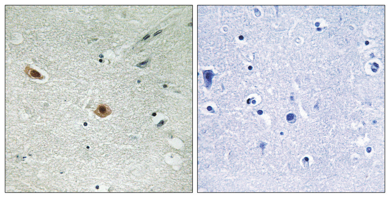 Immunohistochemical analysis of paraffin-embedded human brain tissue using Retinoblastoma (Phospho-Ser608) antibody (left) or the same antibody preincubated with blocking peptide (right) .