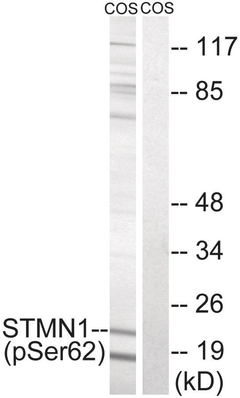 Western blot analysis of extracts from COS cells treated with nocodazole using STMN1 (Phospho-Ser62) Antibody. The lane on the right is treated with the antigen-specific peptide.