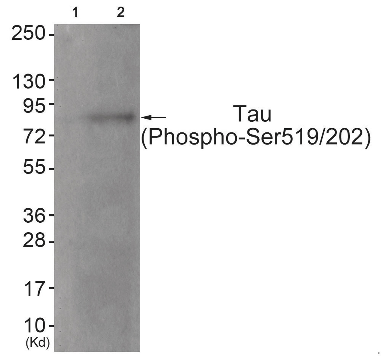 Western blot analysis of extracts from JK cells (Lane 2) , using Tau (Phospho-Ser519/202) Antibody. The lane on the left is treated with antigen-specific peptide.