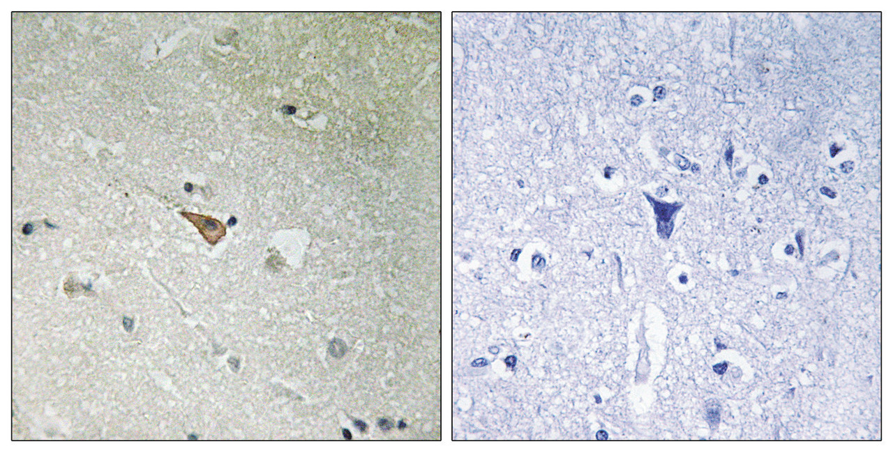 Immunohistochemical analysis of paraffin-embedded human brain tissue, using ALK (Phospho-Tyr1096) antibody (left) or the same antibody preincubated with blocking peptide (right) .