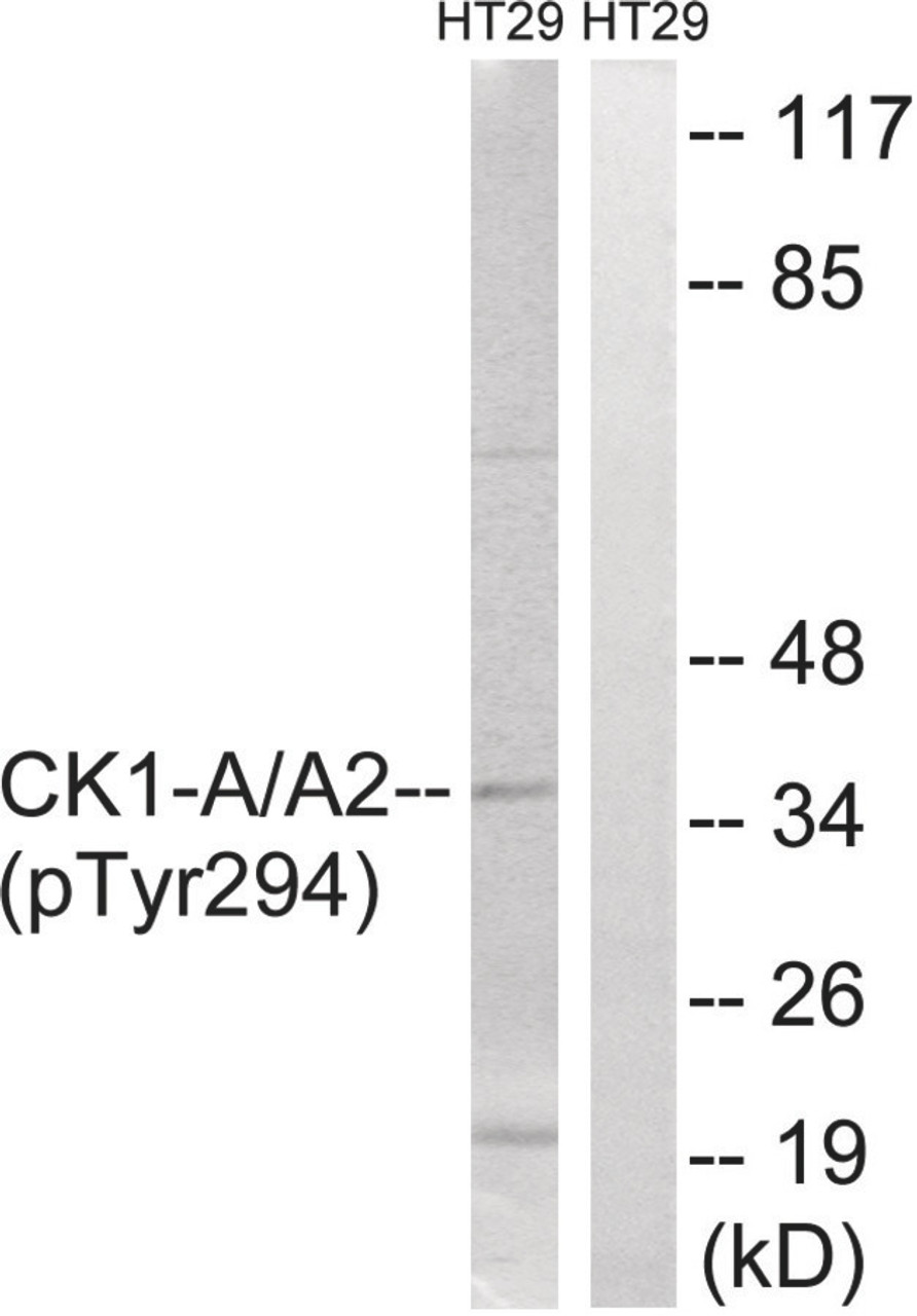 Western blot analysis of extracts from HT-29 cells treated with heat shock using CK-1alpha (Phospho-Tyr294) Antibody. The lane on the right is treated with the antigen-specific peptide.