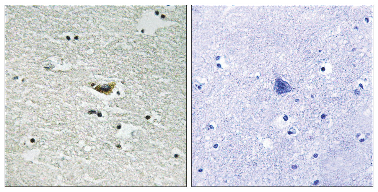Immunohistochemical analysis of paraffin-embedded human brain tissue using CK-1alpha (Phospho-Tyr294) antibody (left) or the same antibody preincubated with blocking peptide (right) .