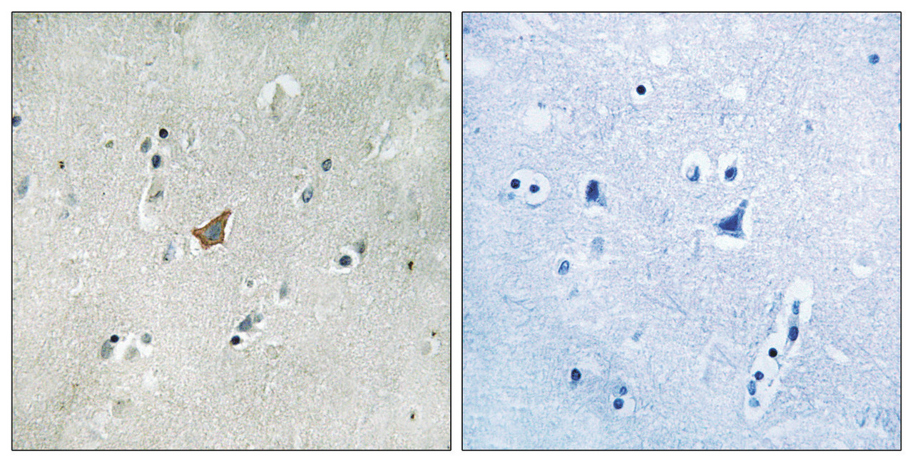 Immunohistochemical analysis of paraffin-embedded human brain tissue using EPHA3/4/5 (Phospho-Tyr779/833) antibody (left) or the same antibody preincubated with blocking peptide (right) .
