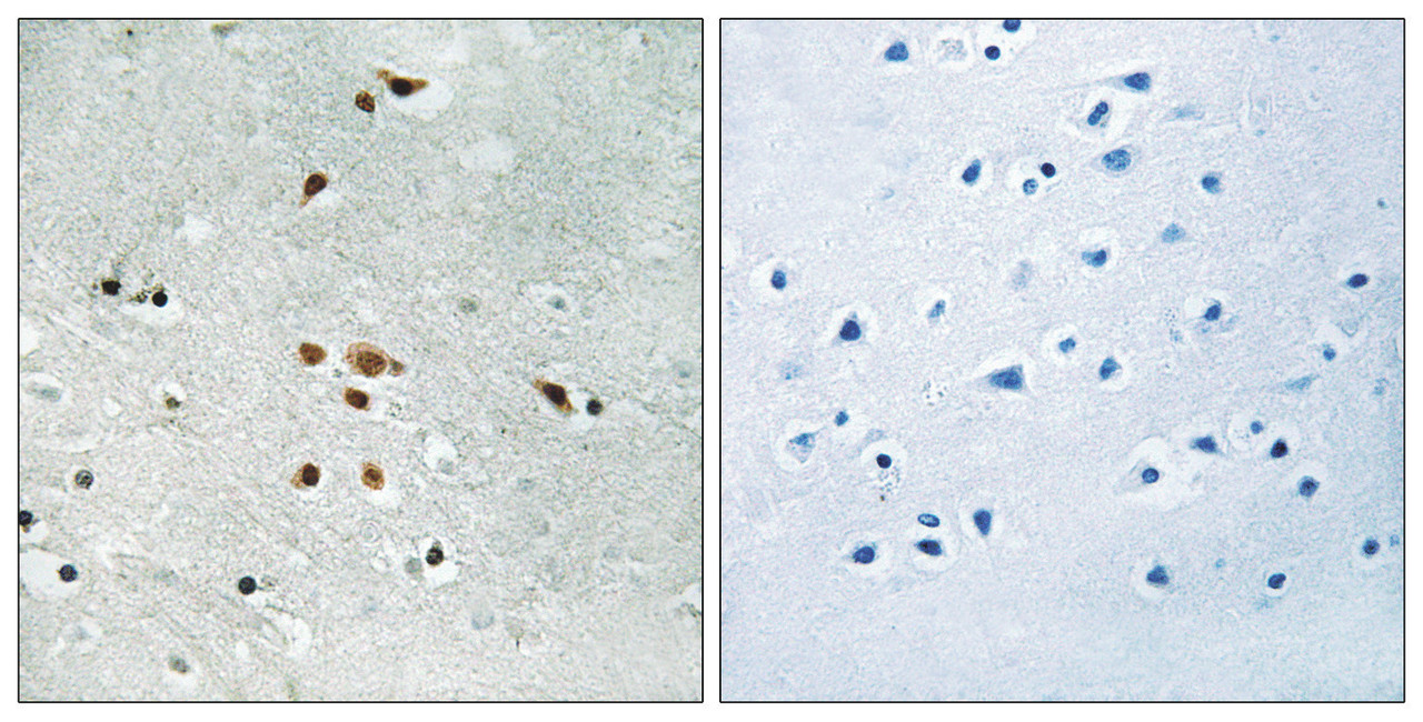 Immunohistochemical analysis of paraffin-embedded human brain tissue using FER (Phospho-Tyr402) antibody (left) or the same antibody preincubated with blocking peptide (right) .