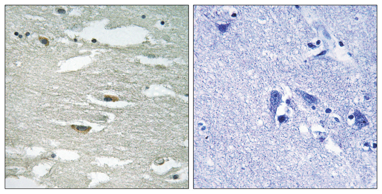 Immunohistochemical analysis of paraffin-embedded human brain tissue using ILK (Phospho-Ser246) antibody (left) or the same antibody preincubated with blocking peptide (right) .