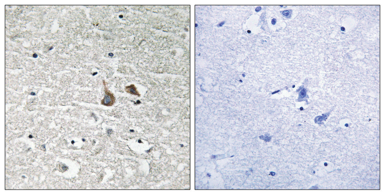Immunohistochemical analysis of paraffin-embedded human brain tissue using IRAK1 (Phospho-Ser376) antibody (left) or the same antibody preincubated with blocking peptide (right) .