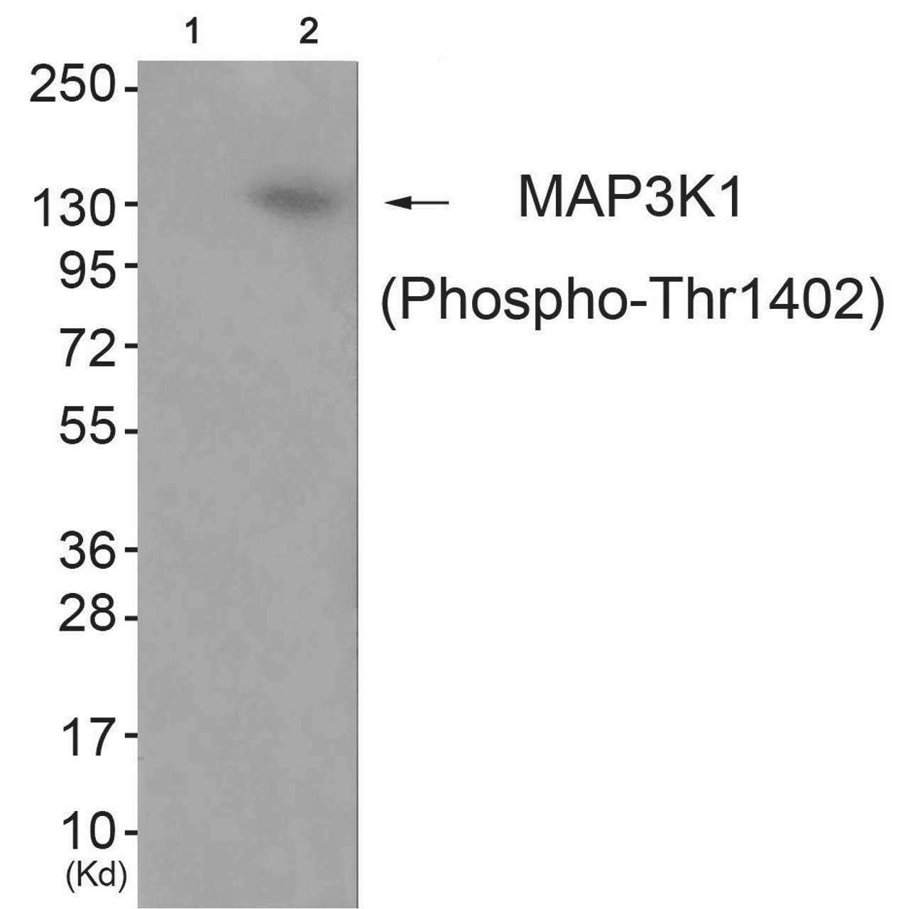 Western blot analysis of extracts from JK cells (Lane 2) , using MAP3K1 (Phospho-Thr1402) Antibody. The lane on the left is treated with antigen-specific peptide.