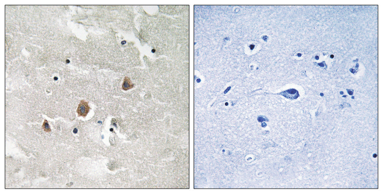Immunohistochemical analysis of paraffin-embedded human brain tissue using MAP3K1 (Phospho-Thr1402) antibody (left) or the same antibody preincubated with blocking peptide (right) .