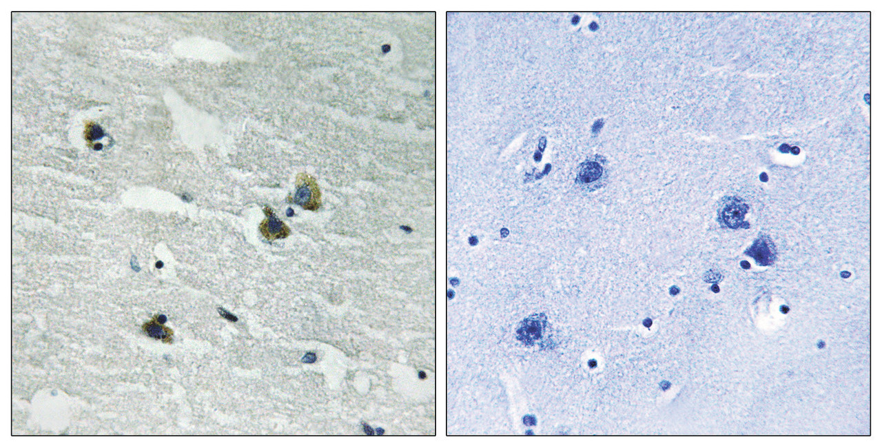 Immunohistochemical analysis of paraffin-embedded human brain tissue using MER/SKY (Phospho-Tyr749/681) antibody (left) or the same antibody preincubated with blocking peptide (right) .