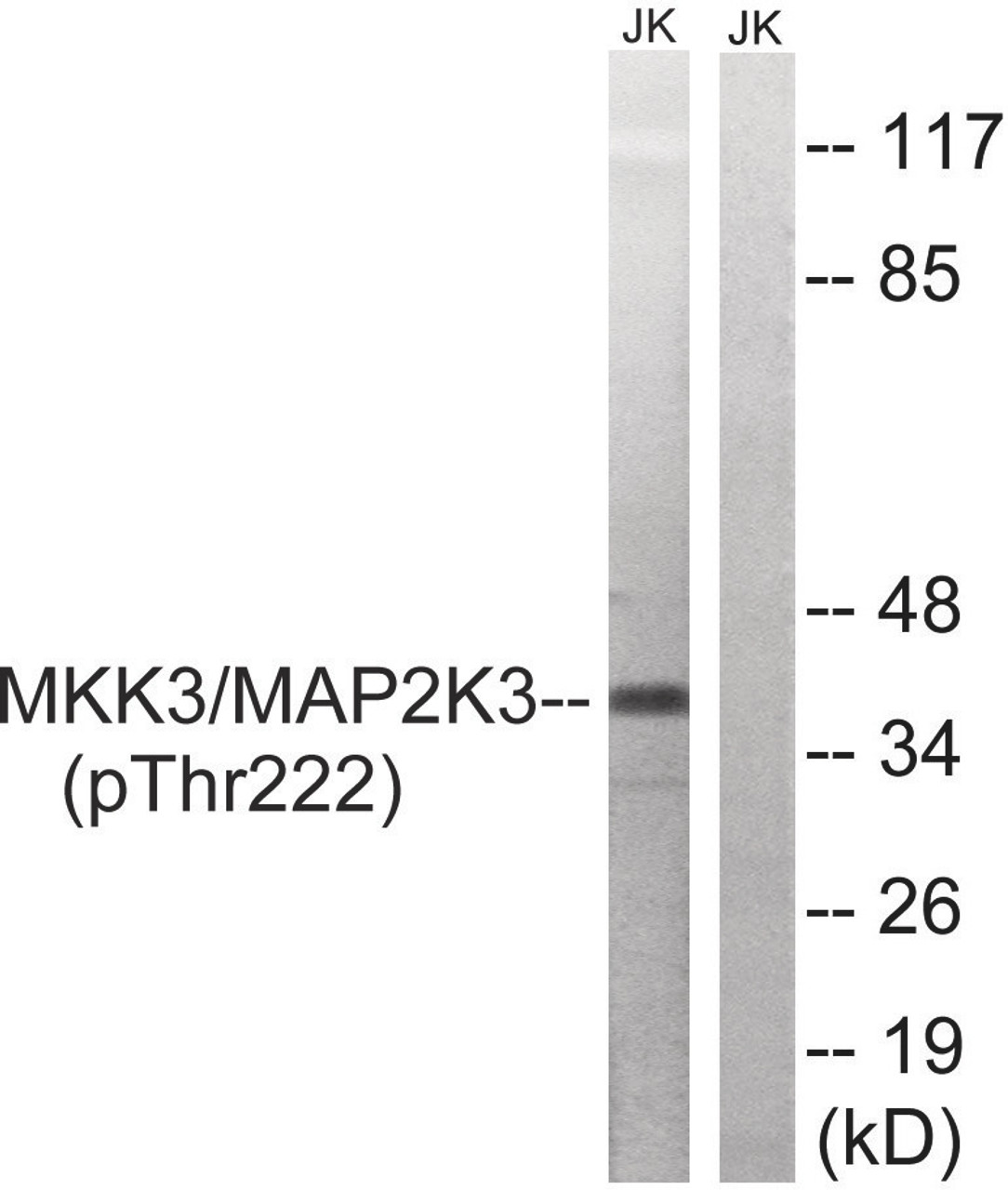 Western blot analysis of extracts from Jurkat cells treated with serum using MAP2K3 (Phospho-Thr222) Antibody. The lane on the right is treated with the antigen-specific peptide.