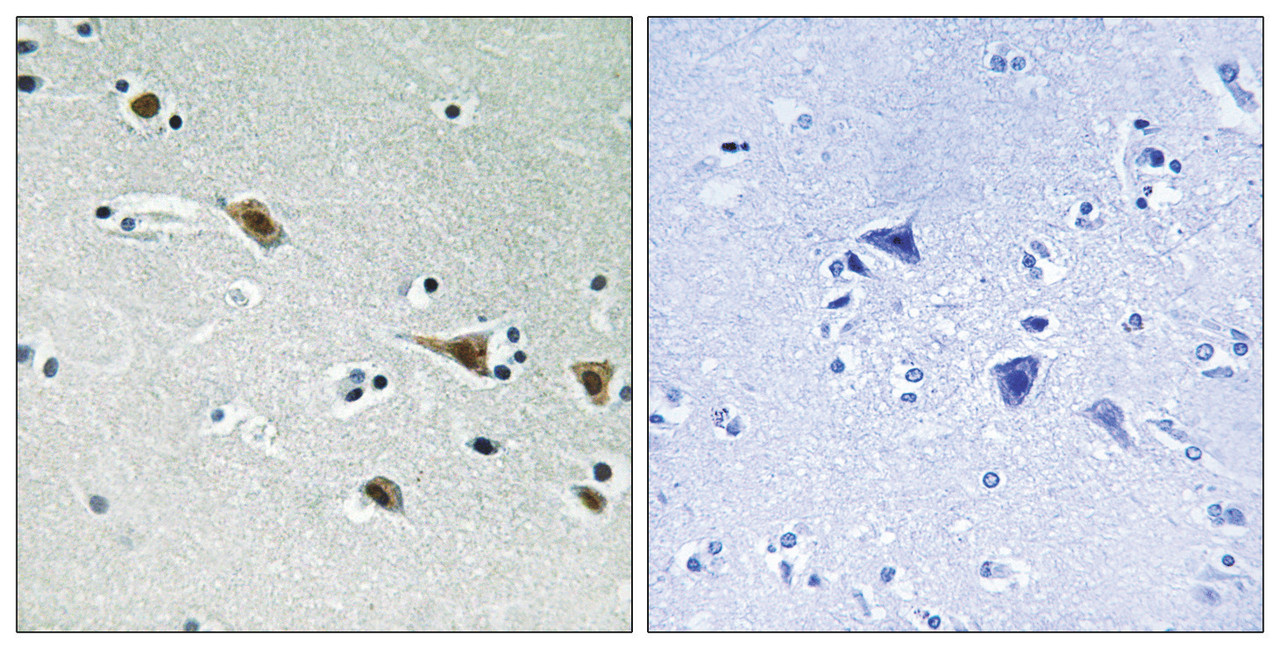 Immunohistochemical analysis of paraffin-embedded humanbrain tissue, using MAP2K7 (Phospho-Ser271) antibody (left) or the same antibody preincubated with blocking peptide (right) .